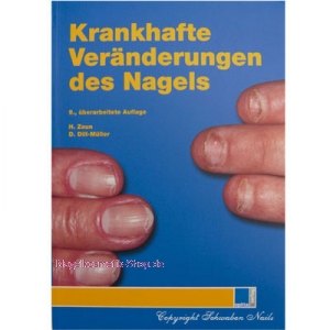 Buch Krankhafte Veränderungen des Nagels